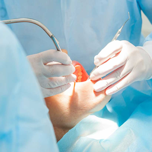 conservativa endodonzia - terapia - Padova Dental Clinic